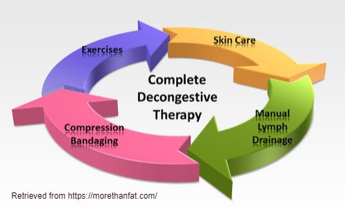 What Is Complete Decongestive Therapy? - Tactile Medical